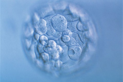 http://hefei.quanwangkm.com/post/190.html|合肥人工试管